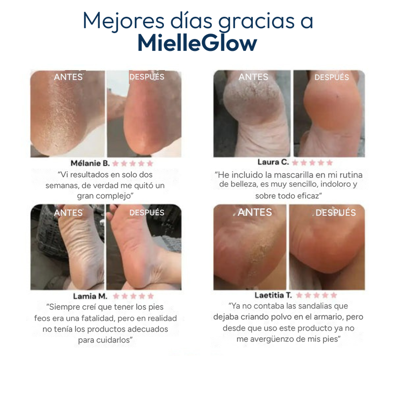 Mascarilla exfoliante para pies MielleGlow