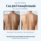 Toalla Exfoliante de Ducha Antibacteriana MielleGlow