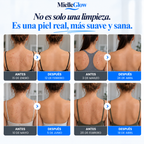Toalla Exfoliante de Ducha Antibacteriana MielleGlow