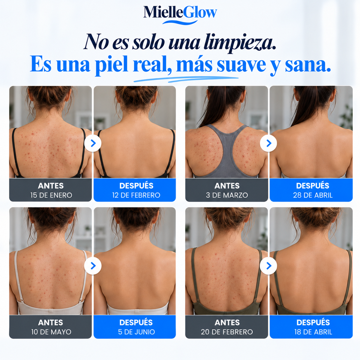 Toalla Exfoliante de Ducha Antibacteriana MielleGlow